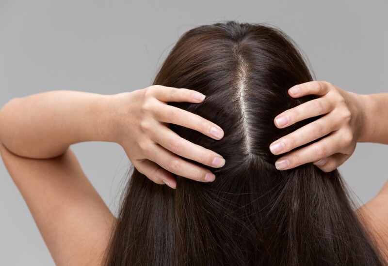 秋冬の気になる頭皮悩みをまるっと解決！トラブルの要因＆ケア方法を専門家に聞きました