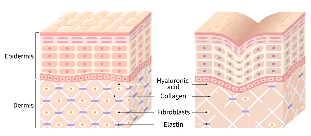 皮膚の構造イメージ